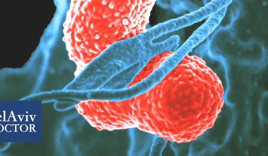 Sepsis-Infection-Signs-Treatment | Tel Aviv Doctor What is Sepsis – Medical Background and Warning Signs - Part 2